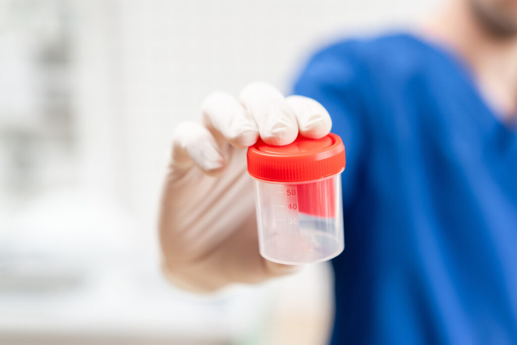 Drug Testing