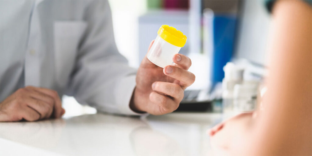 What Do Pre-Employment Drug Tests Look for