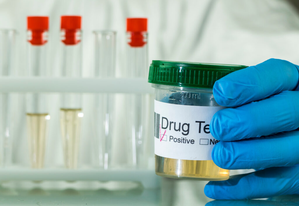drug test
