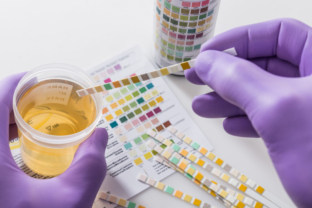 Drug Testing